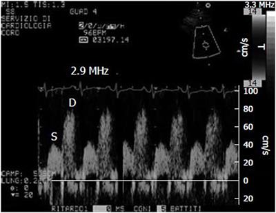 Cardiovascular Imaging Techniques in Systemic Rheumatic Diseases